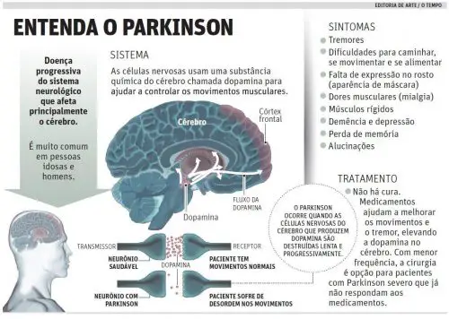 Entendendo o Mal de Parkinson